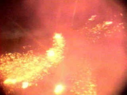 entry picture